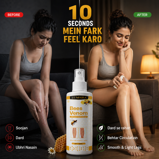 Bee Venon Varicose Veins Spray(100 ml) || BUY 1 GET 1 FREE